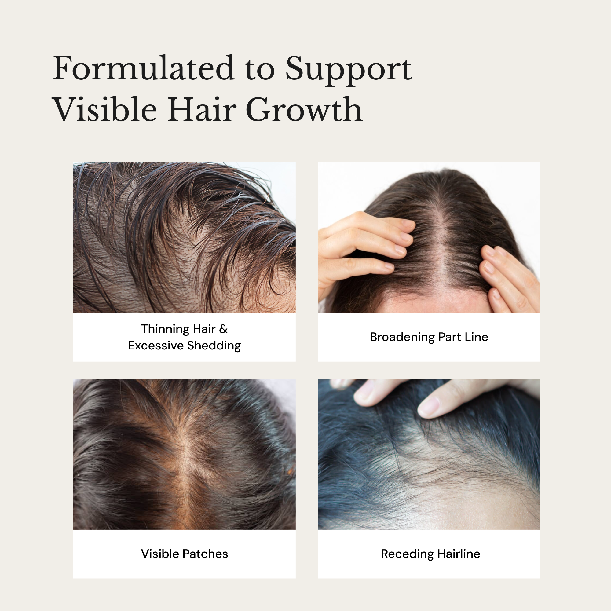 ANAGROW® – Advanced Hair Regrowth Serum with Apple Stem Cells