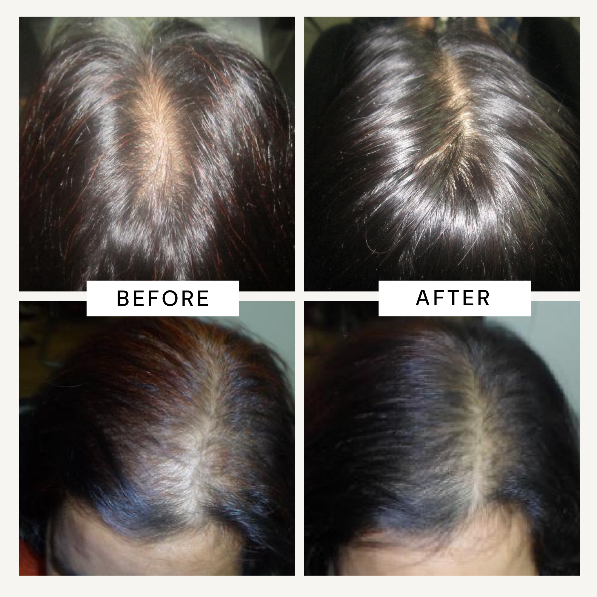 ANAGROW® – Advanced Hair Regrowth Serum with Apple Stem Cells