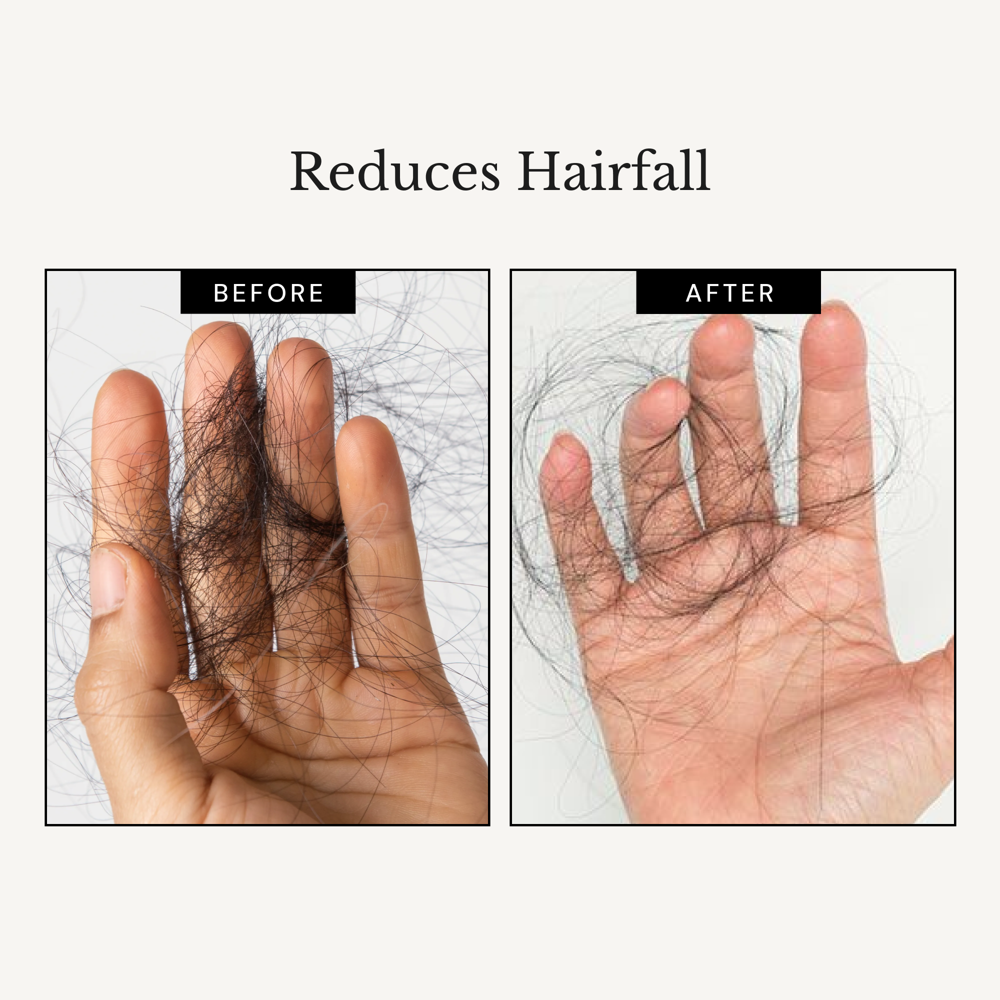 RICHFEEL Scalp Cleanser with Saw Palmetto | Premium Anti-Hair Fall & DHT Blocker Shampoo  (Pack of 3)